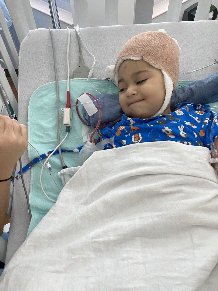 Gustavo8_'s tweet photo. Ahora solamente tiene un hemisferio derecho y una cavidad vacía en su otro lado. Debido a la complejidad de la cirugía y lo que implica quitar la mitad de su cerebro, Giulia estuvo sedada durante los 2-3 primeros días. Abría los ojos por segundos y volvía a dormir. También tenía https://t.co/S6qzeFC9Od