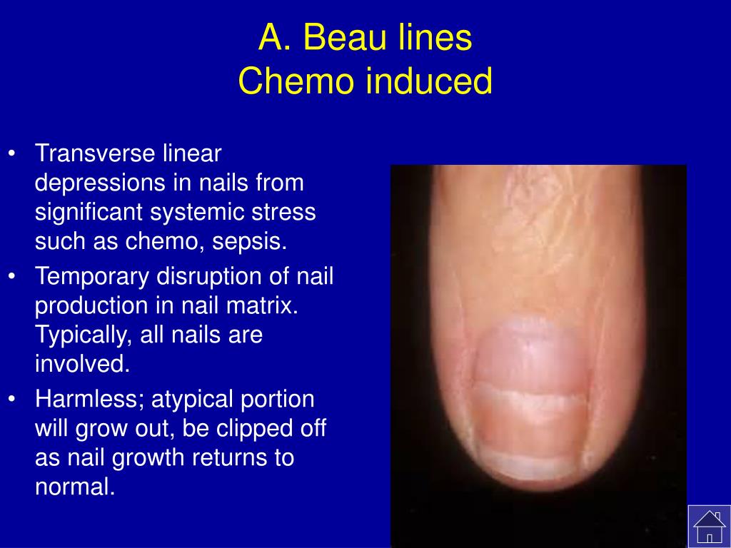 Nail Deformities and Dystrophies - Dermatologic Disorders - MSD Manual  Professional Edition