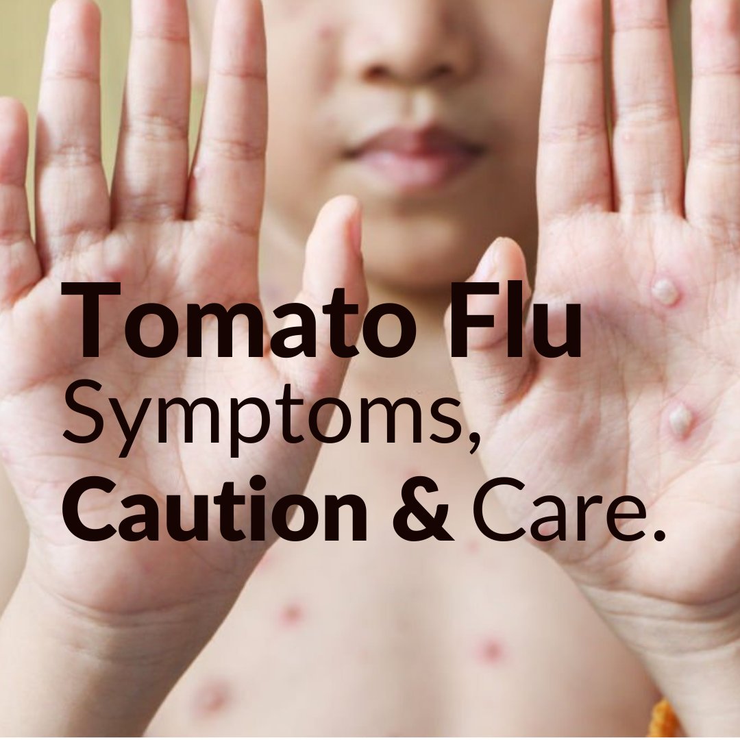 Tomato Flu cases are increasing especially among children. Here’s what you should know and protect your family from it.

Read the article to learn more from Meet the Mom section via the link: rabitat.com/blogs/news/how…
.
#TomatoFlu #Tips #parenting #ParentingTips #flu #article #Read