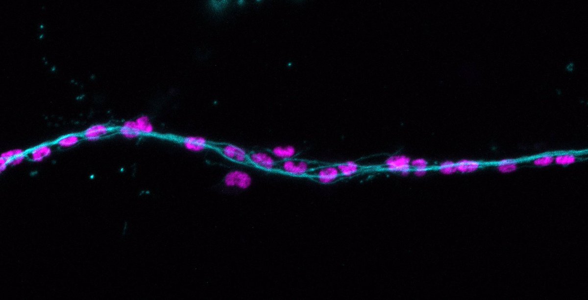 K_E_Smith86's tweet photo. Had a fantastic week with @carlagriffs @UCLEarInstitute hosting 3 incredible @in2scienceUK students! On their final day the students presented their work including this amazing image of glial cells (pink) aligning with neuronal axons (light blue)π https://t.co/XYfzuGnUUg