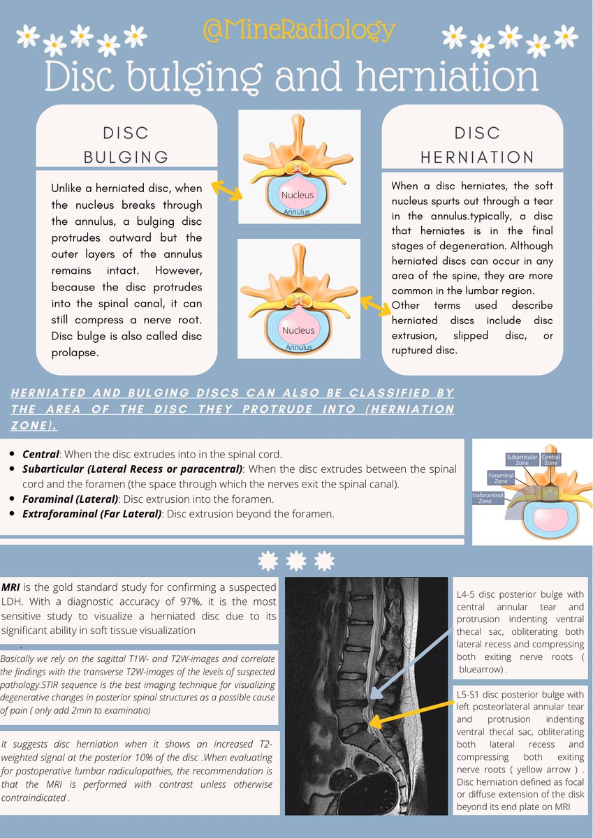 MineRadiology's tweet photo. #Disc_degeneration #disc_prolapse #disc_herniation #disc_bulging #STIR #MRI #spine #Back_pain #radiology #radiologist #radiographer https://t.co/XtFuJYMmQI