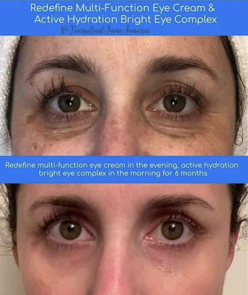 shutcherson's tweet photo. Do yourself a favor. Buy the eye creams. 👏🏽
They last me 4-6 months each!
Plus you can get them split into 4 interest-free payments!

https://t.co/BM2v0h3VcG https://t.co/ZYE8fTSEJi