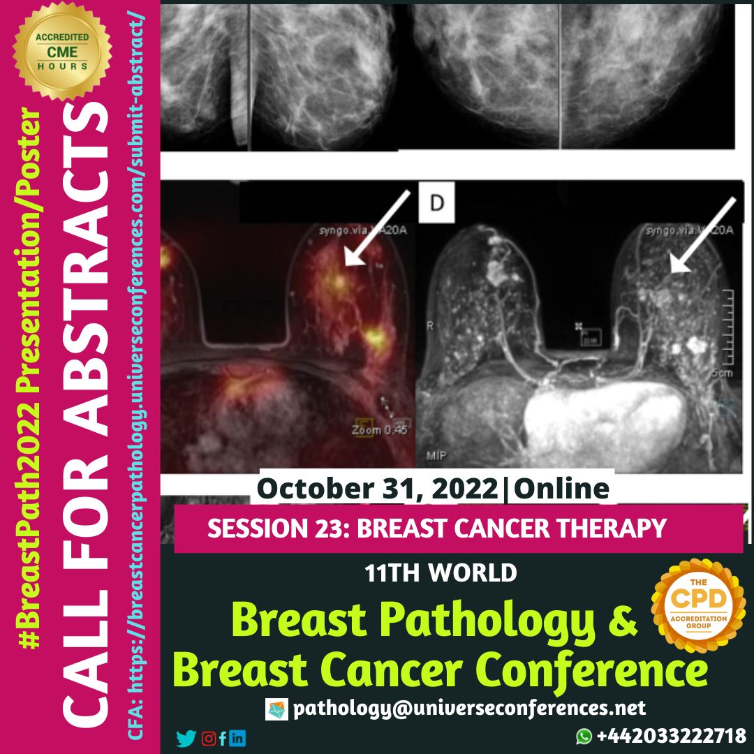 breastcanucg's tweet photo. Track 23: Breast Cancer Therapy:-
On October 31, 2022, to participate in the online version of the CME/CPD-accredited 11th World Breast Pathology &amp; Breast Cancer Conference. 
Submit your paper here: https://t.co/ucF4hxHS2E
#breastcancerresearch #borspatologie #පියයුරුසැත්කම්නම https://t.co/C1alm6Z6rr