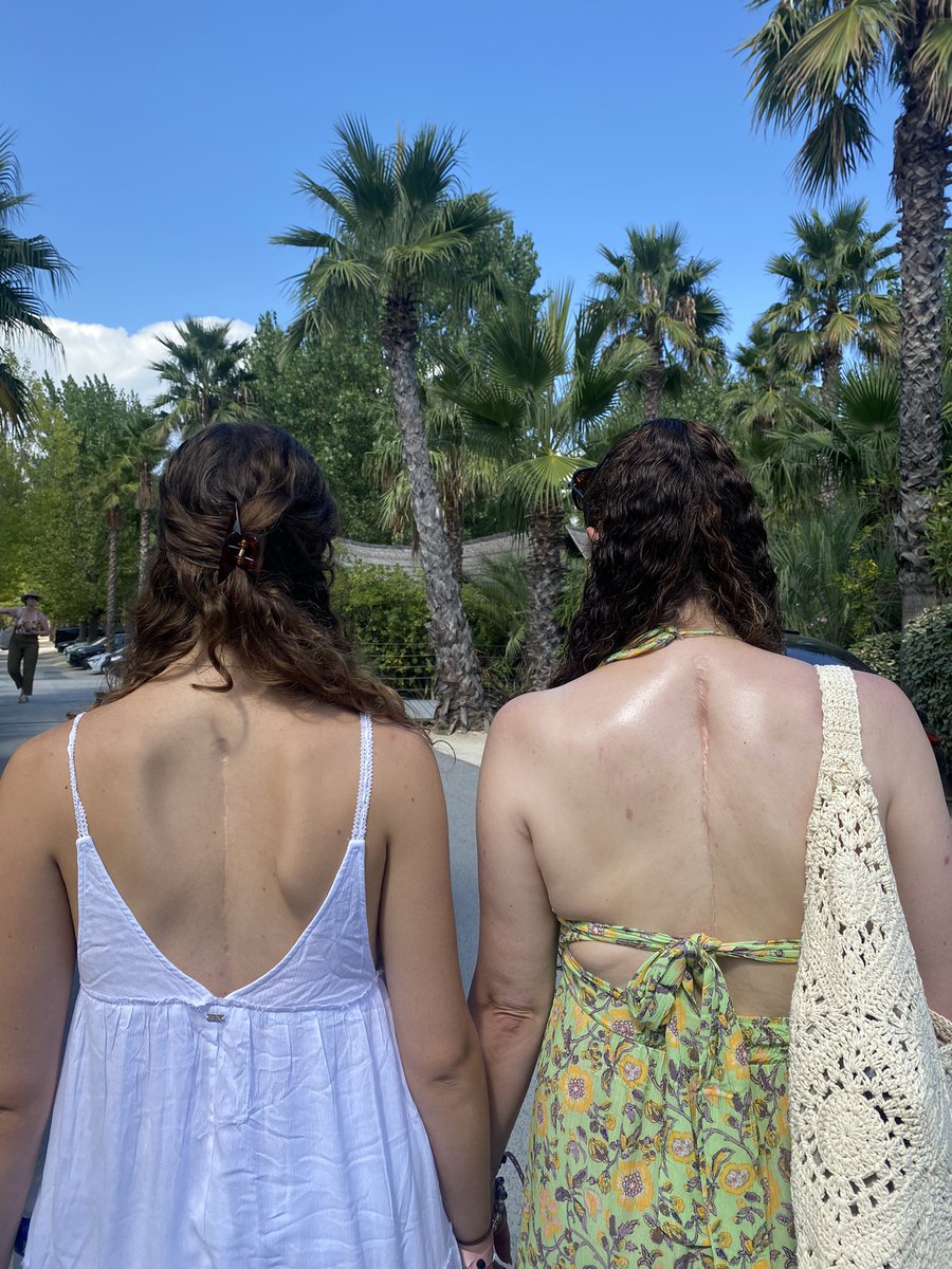 Mum and daughter scars (1985, 2013) 28 years apart! Hers is so much neater but mine was opened up three times so it’s ok 😂 anyway scars out and enjoying the beach ❤️ @ScoliosisUK #scoliosis