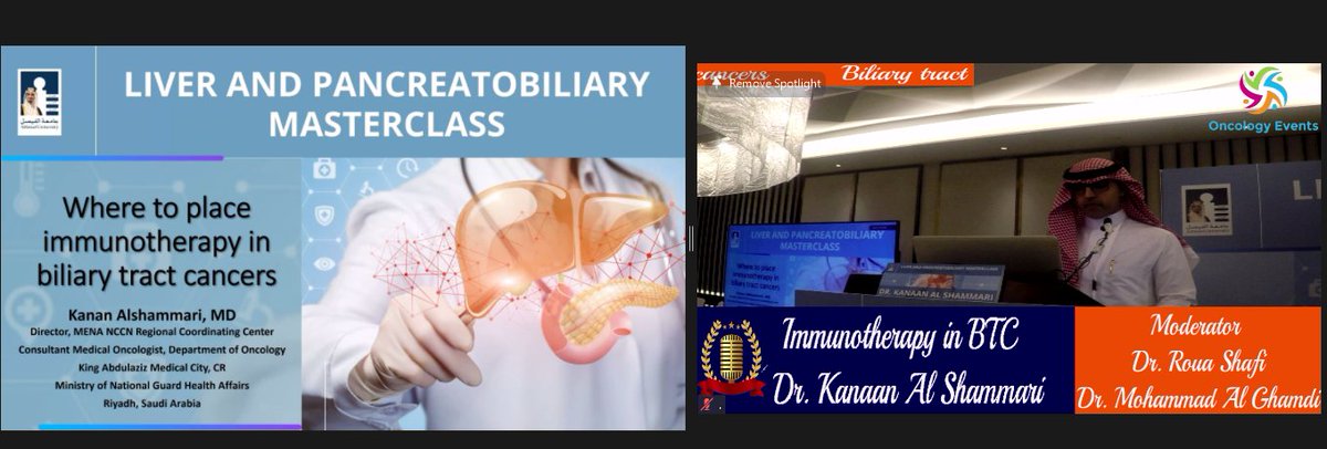 Oncology_Events's tweet image. 📢LIVER AND PANCREATOBILIARY MALIGNANCIES MASTERCLASS 2022 #LPMM  
📢#Immunotherapy in BTC 
By @Dr_Kanaan07  the Director, #MENA_NCCN Coordinating Center
     🤩
🫲🥼🫱
📢 This lecture was attended by 1️⃣0️⃣0️⃣0️⃣HCP on 
@Zoom and 3️⃣3️⃣1️⃣on @YouTube
 youtube.com/watch?v=g_Qtcv…