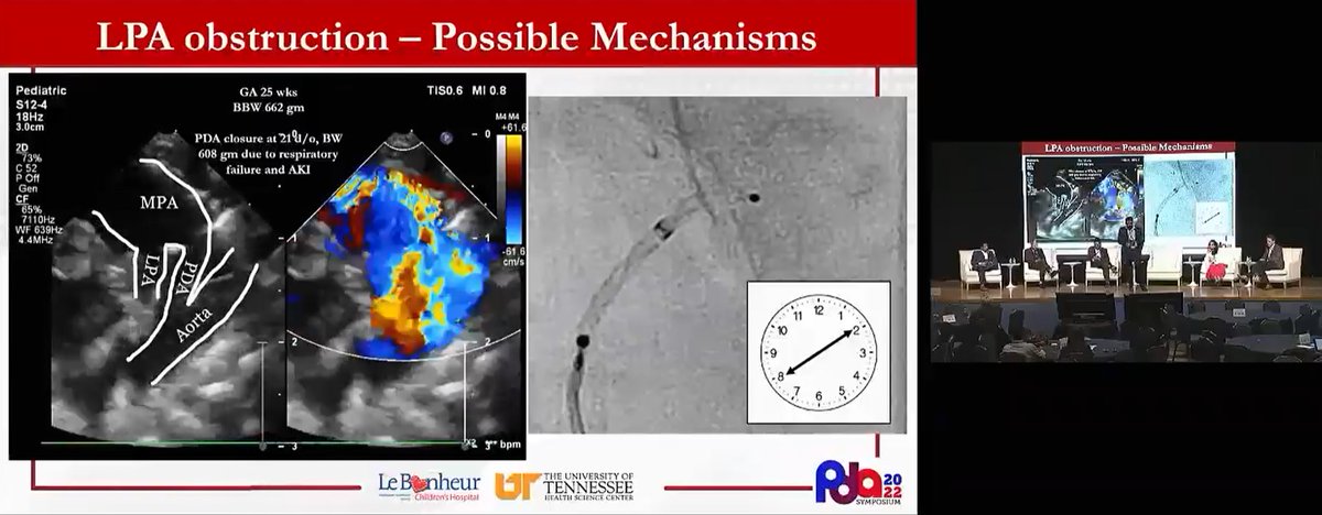 PDA Symposium (@pdasym) on Twitter photo 📺Watch #PDASym recorded sessions <a href="/NeoHeartSociety/">Neonatal Heart Society</a>
🫀 Interventional Track On Demand has excellent talks and discussion
1⃣Avoid TV injury
2⃣Avoid LPA/Arch obs
3⃣ #echofirst eval
4⃣Bedside closure
5⃣Avoid vasc injury
& More!
Log into #neoheart click 👉On Demand
#neoTwitter 📺Watch #PDASym recorded sessions <a href="/NeoHeartSociety/">Neonatal Heart Society</a>
🫀 Interventional Track On Demand has excellent talks and discussion
1⃣Avoid TV injury
2⃣Avoid LPA/Arch obs
3⃣ #echofirst eval
4⃣Bedside closure
5⃣Avoid vasc injury
& More!
Log into #neoheart click 👉On Demand
#neoTwitter