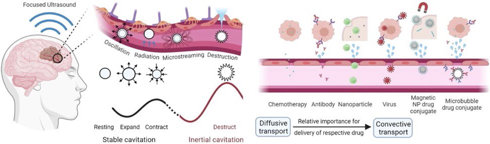 #paperofthemonth
Great strides are being made towards improving transport of anticancer agents across the BBB via microbubble-enhanced focused ultrasound.Non-invasive tech is used to enable new therapeutic strategies to address significant challenges in treating #braintumours.