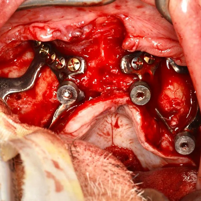 boneeasy's tweet photo. FAQ.
How do I rehabilitate Implantize Compact?
Emerging from the gum you will see standard Multiunits abutments that are compatible with the majority os dental implant systems, so you just have to use your regular prosthetic protocols
#implantizecompact
#dentalimplants https://t.co/gyTKOQtXrj