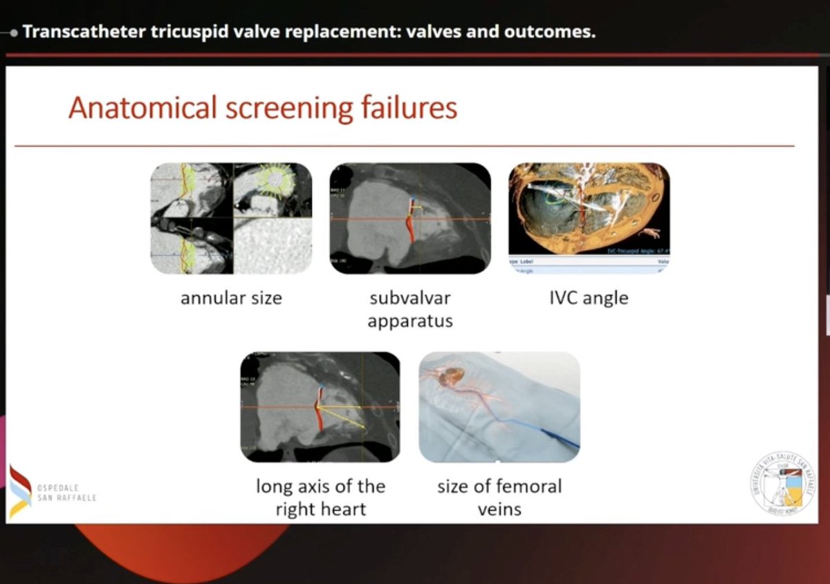 San Raffaele Heart Valve Center tweet media