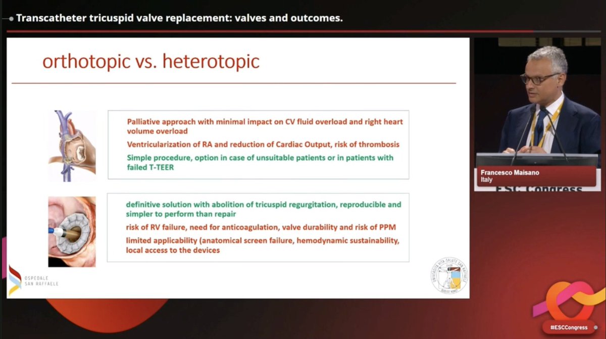 San Raffaele Heart Valve Center tweet media