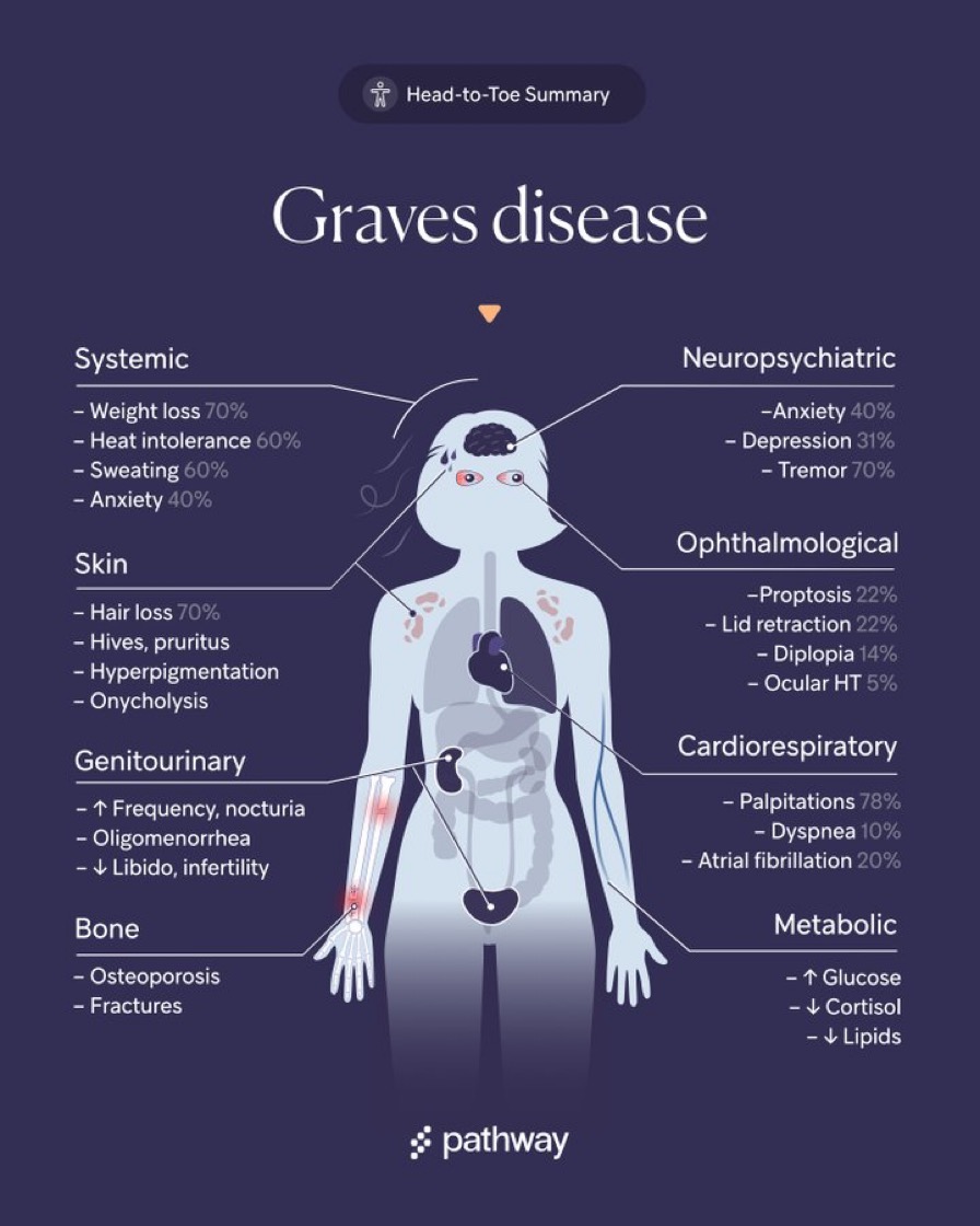 brown-hospital-medicine-on-twitter-graves-disease-overview