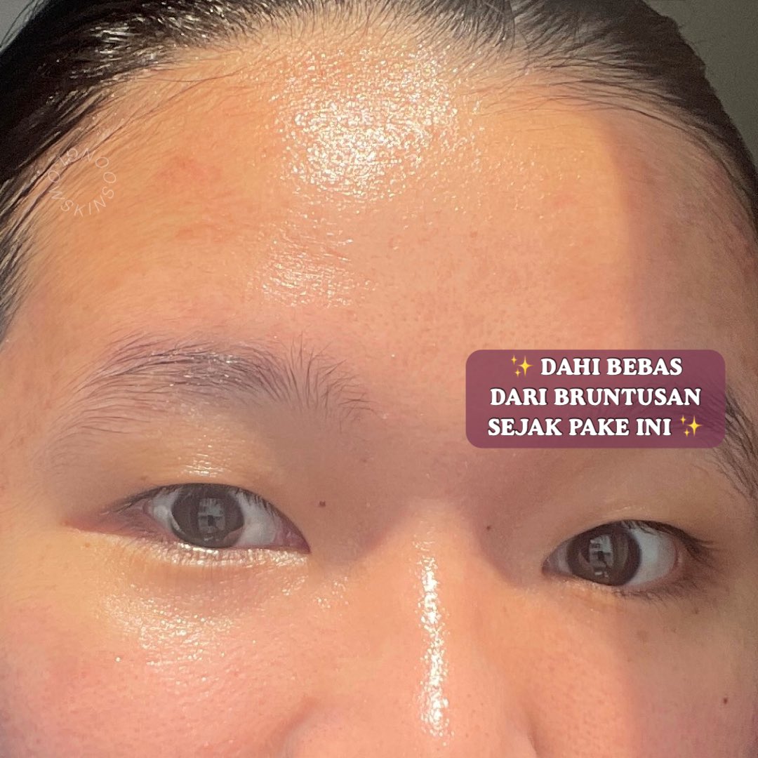 moisturizer untuk skin barrier cuman 40kan ini beneran worth to have bagi semua jenis kulit! The Originote ini endul😭🫶🏻

- tekstur gel ringan bgt
- gampang nyerap, ga bikin greasy
- lembabnya oke
- bagus buat skin barrier
- ISI BANYAK 50ML

detail thread⤵️⤵️ #racuninskincare
