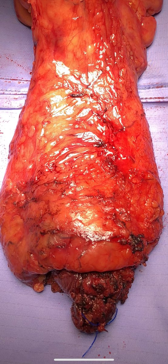 Antonio Caycedo-Marulanda MD, MSc. tweet media