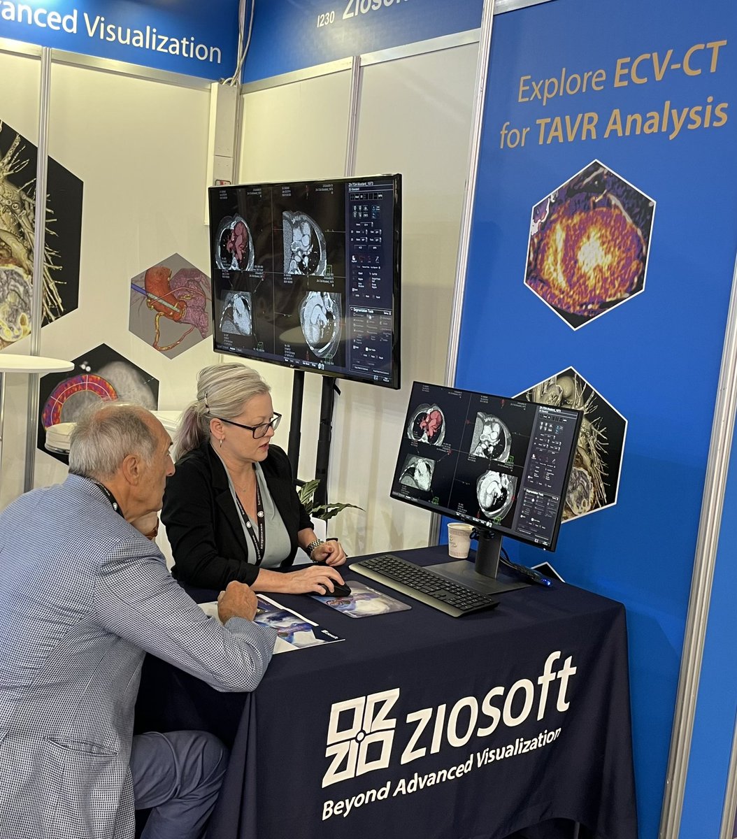 ziosoft's tweet photo. 2nd day at ESC 2022 in Barcelona.  Impressive interest in Ziosoft’s Cardiac imaging solutions. Visit us at ESC booth I-230. #esc2022 #esccongress #tavi #tavr #cardiology #cardiacimaging #radiology https://t.co/1W8697Mic6