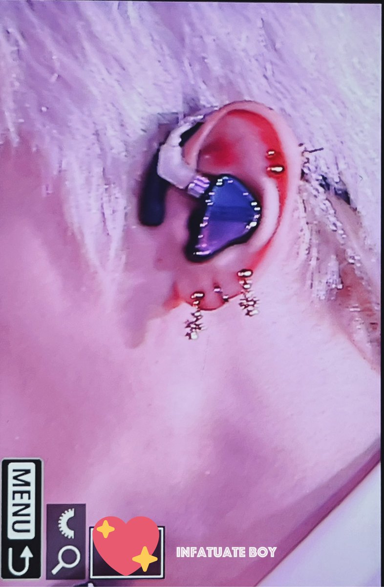 TyonggTyonggg's tweet photo. Taeyong got new helix piercing??? Looks like it but not sure tho… https://t.co/fBFDJlkE1D