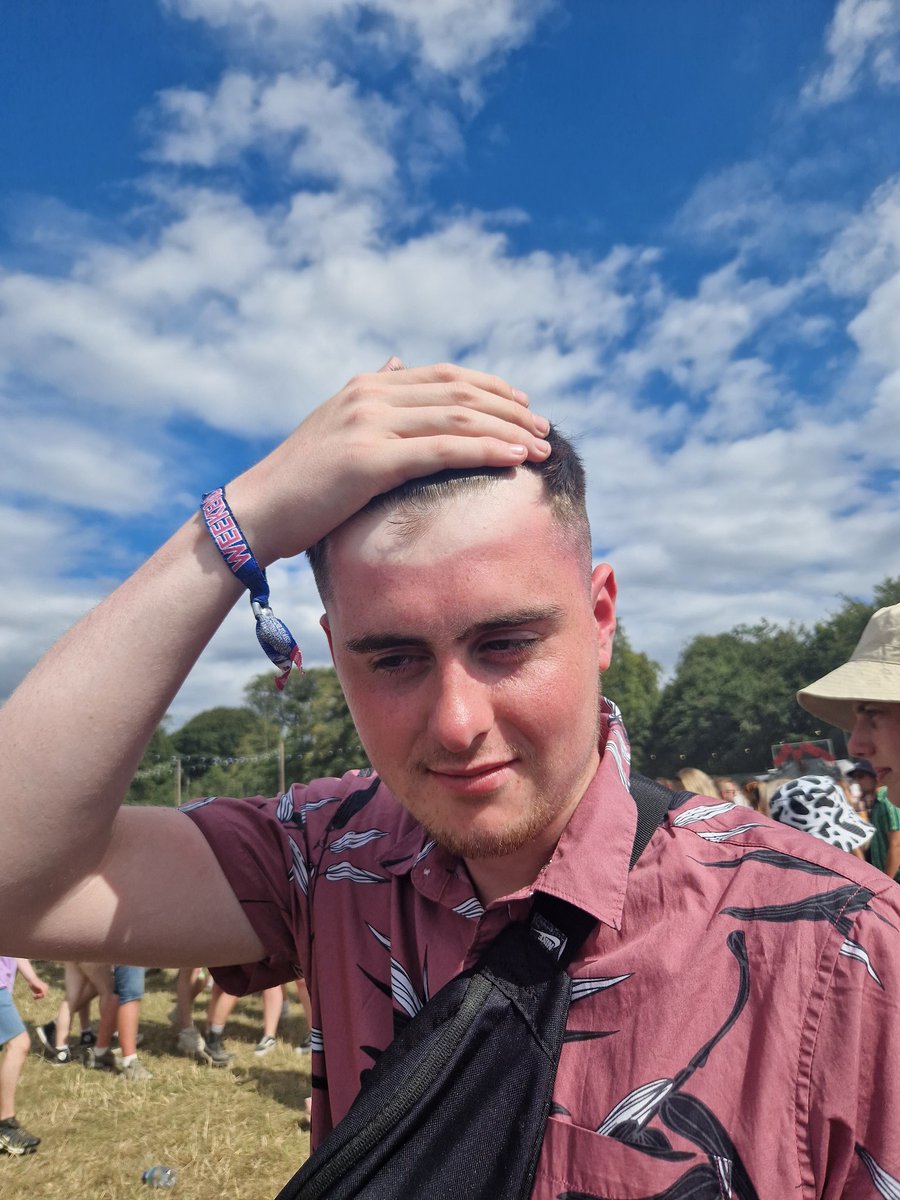 Some sunburn that is #NoMusicOnADeadPlanet #Leedsfestival2022