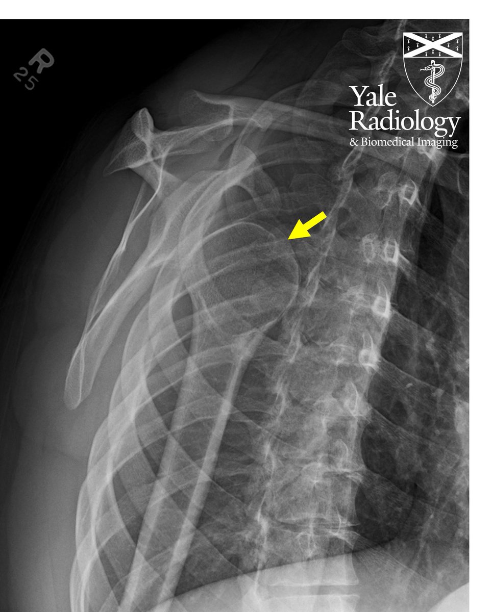 YaleRadiology tweet picture