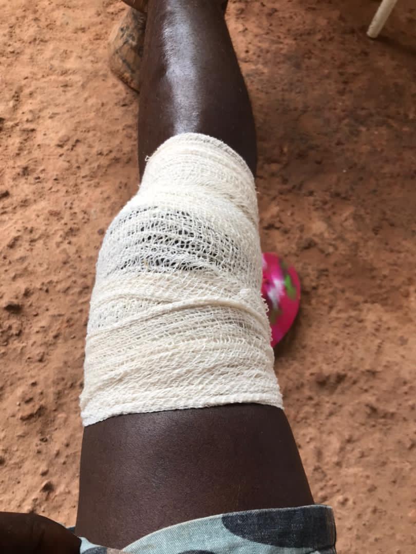 Any help with my bro because this days we are busy on treatment 🙏🙏🙏 he is having a accident with