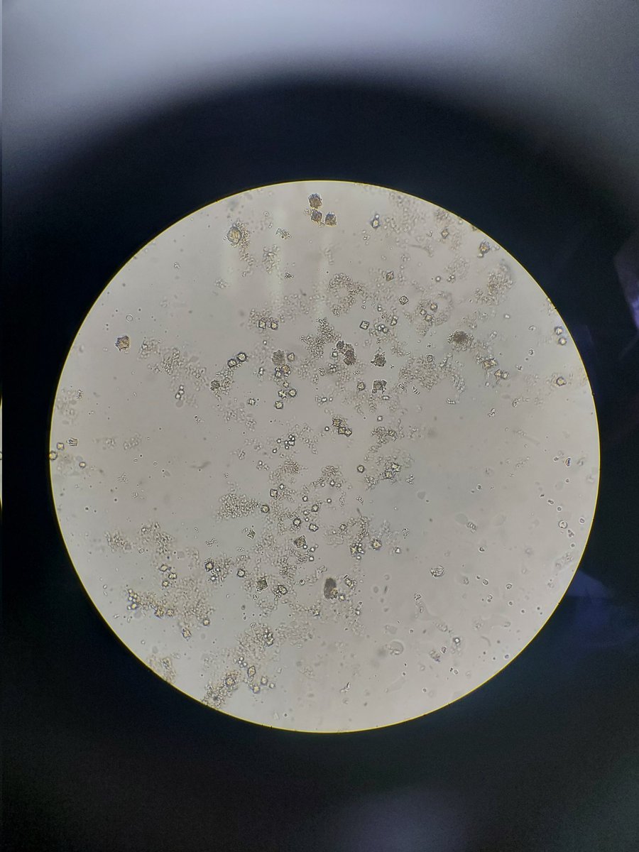 dazaetgb's tweet photo. A new ZrMOF! π€
Nevertheless, crystals are so tiny stiil!
You can see octehedra crystals under a 40x microscope image :(
Any advice to get bigger crystals enough to be diffracted by synchrotron?
#MOFs
#MOF
#ReticularChemistry
#SolvothermalSynthesis https://t.co/VOSheqt523