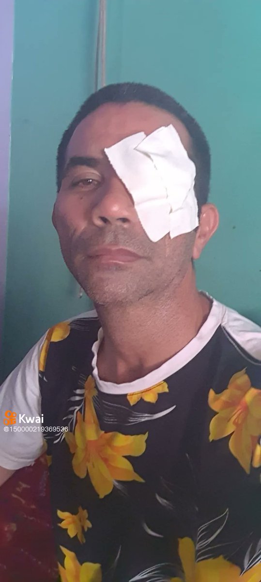 ZinhoRoots33's tweet photo. Com olho operado mas secando o papaum pra cima abc #SERIECNABAND https://t.co/3pxRn7OwnO