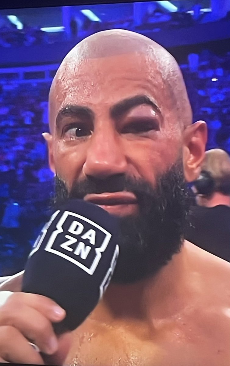 septimusajprime's tweet photo. Deji rearranged a man’s whole face 😭 #KSI2Fights1Night #KSISwarmz https://t.co/NBtGeVDBNu