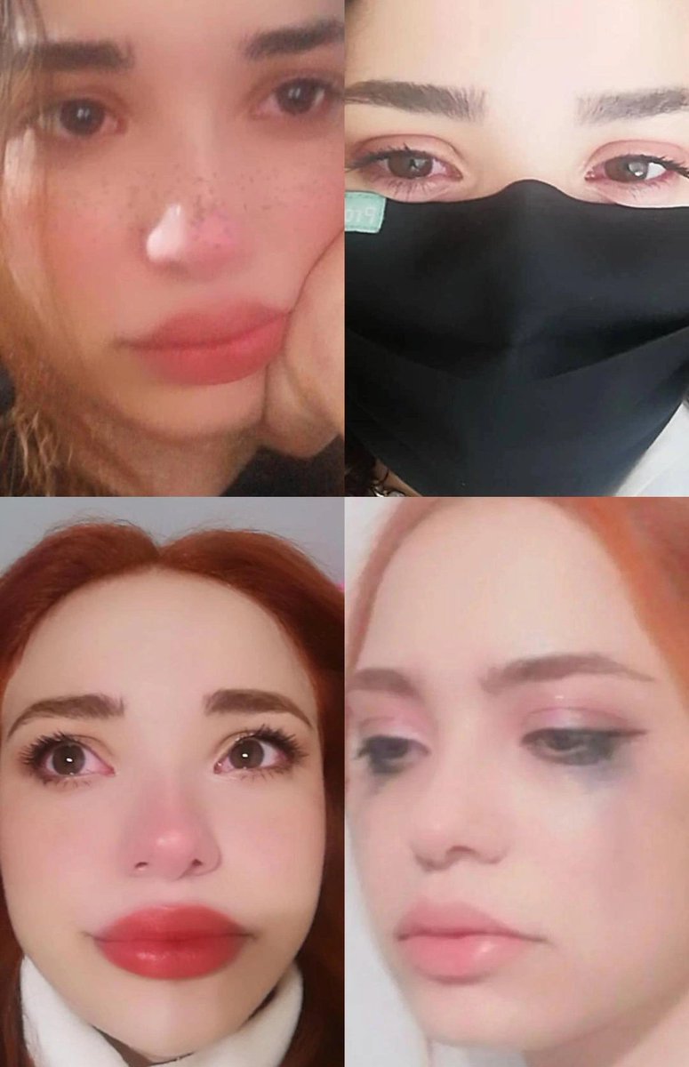 benim mental sağlık