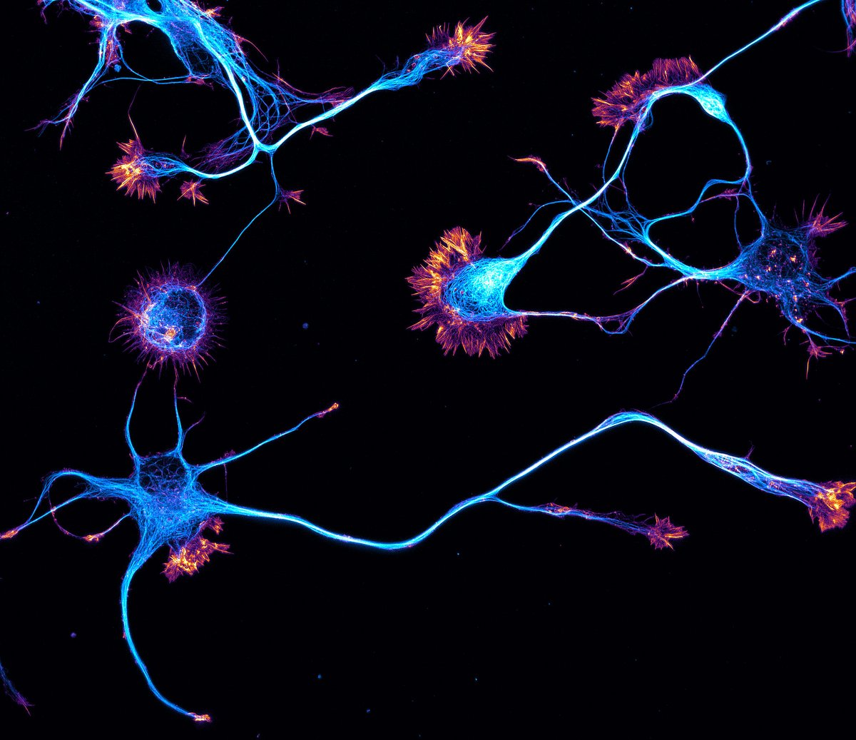 Rat hippocampal neurons (microtubules and actin)

By Dr. Christophe Leterrier

#neuroscience #neurotwitter #science #sciencetwitter #radiology #neurology #Bioinformatics #biochemistry #anatomy #MedTwitter