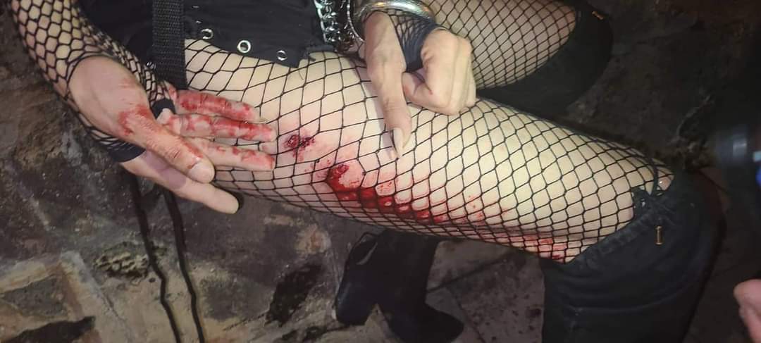Kilometro0PR's tweet photo. "Corrimos por la San Sebastián hacia la Perla pero los guardias seguían persiguiéndonos. Las piernas me empezaron a flaquear. No podía mantenerme de pie. No entendíamos por qué seguían tiroteándonos y corriéndonos si ya nos dispersamos" 1/2 👇🏽 https://t.co/dTCxsqhBbp