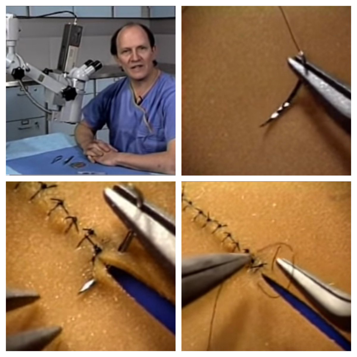 DanHeifermanMD's tweet photo. Want to learn the basics of microsuturing for bypass surgery? 

I highly recommend Dr. Acland’s videos

He reviews “causes of frustration, entanglement, and despair” and tricks to avoid them

Perfect for #Neurosurgery residents

https://t.co/FtO45iOiMm

@youngneuros @cvsection https://t.co/WvhfaZorH7