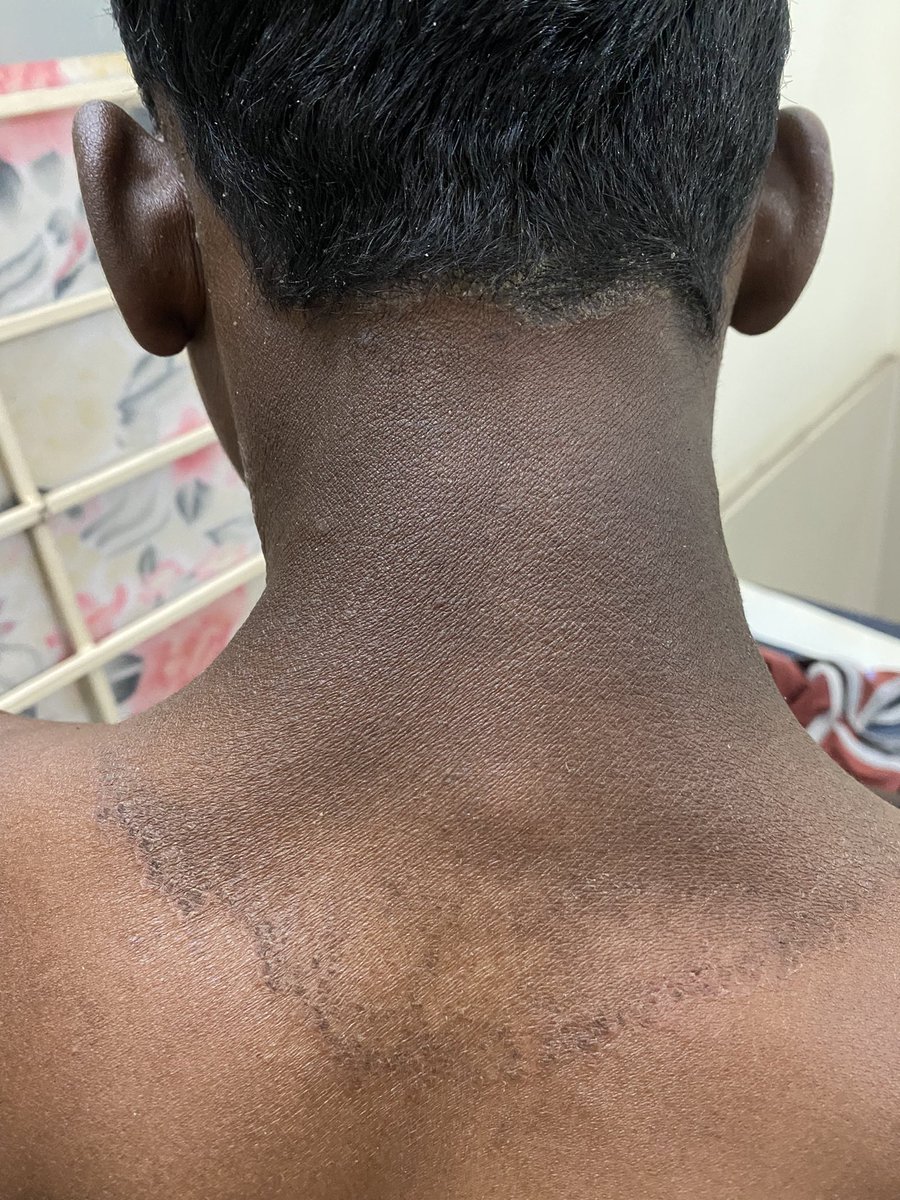 ArunInamadar's tweet photo. Spotter 22: clue … chronic alcoholic https://t.co/uNAGQZRo5T