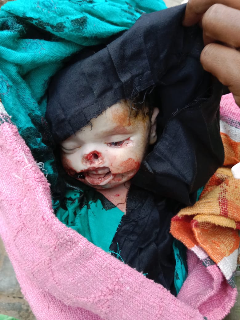 mediacellsp's tweet photo. गोंडा के मुजेहना CHC पर भारी लापरवाही सामने आई है ,

डिलिवरी के पश्चात डिलिवरी रूम में बच्चे को रखा गया जहां जंगली जानवर ने बच्चे का मुंह खा लिया ,

योगी राज में यूपी में सरकारी अस्पतालों के ये शर्मिंदगी भरे और शर्मनाक भयावह असुरक्षित हालात हैं ,

जनता आखिर क्या करे और कहां जाए ? https://t.co/uTU72TuDCR