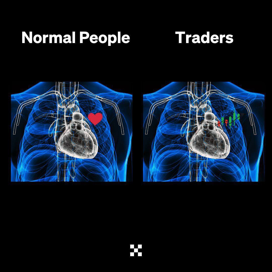 Sabeenlim's tweet photo. normal people vs trader 😍 https://t.co/b9maZ3C85t