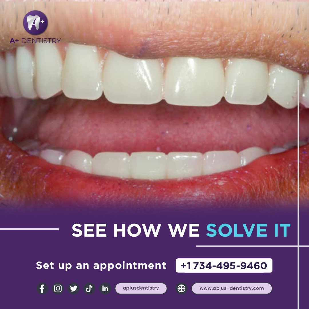 Aplus dentistry (@dentistry_aplus) / Posts / X