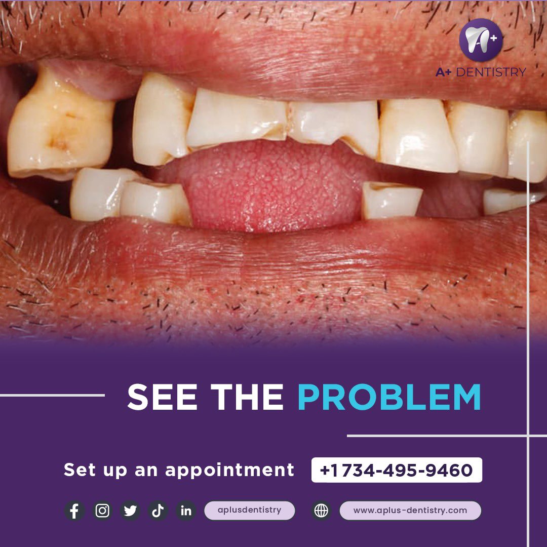 Aplus dentistry (@dentistry_aplus) / Posts / X