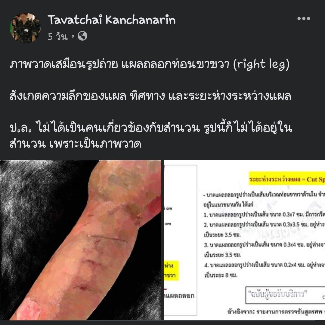 5thBusoh's tweet photo. จาก FB คุณหมอ #saveหมอธวัชชัย กับการรายงานผลการชันสูตรที่ยังมีข้อกังขาอยู่อีกหลายจุด
#แตงโมต้องได้รับความยุติธรรม https://t.co/e5JxDM6Wes