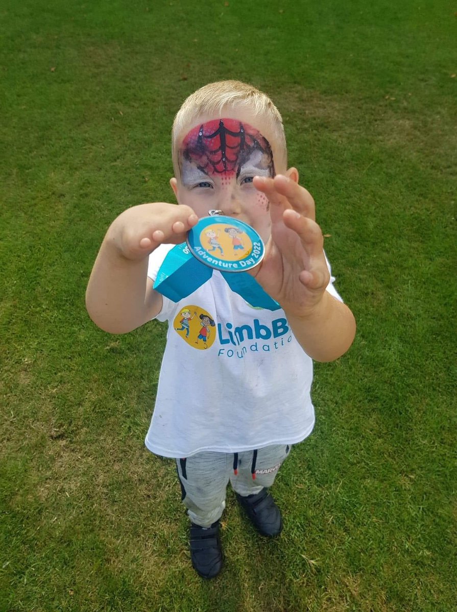 LBofoundation's tweet image. A day of laughter, new friendships and total acceptance of their #limbdifferences thank you to everyone involved @CawthorneCC @DanJarvisMP @HYWEL_ROBERTS @debrakidd @Mrs_H11 @watts_verity @KoalaaCommunity @openbionics @OpenHousePicts @BAPPforBolts @magsanimals