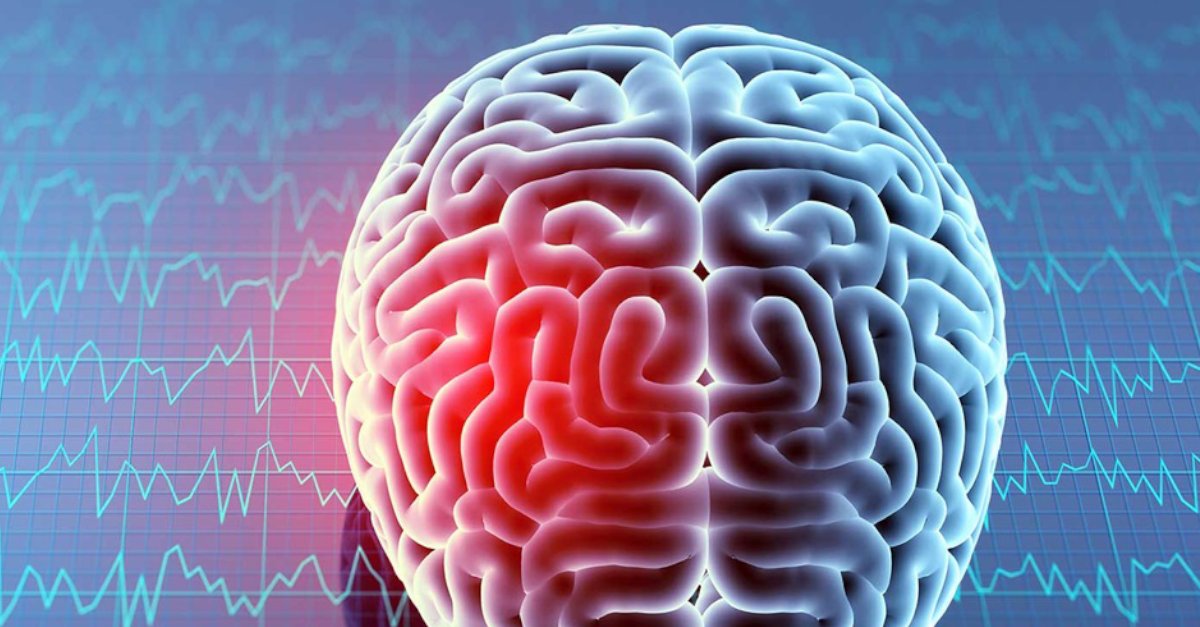 More than 50% of patients with mild TBI and a negative head CT scan have not recovered completely 6 months after sustaining their injury, new data from the TRACK-TBI study shows. ms.spr.ly/6013jdxyX