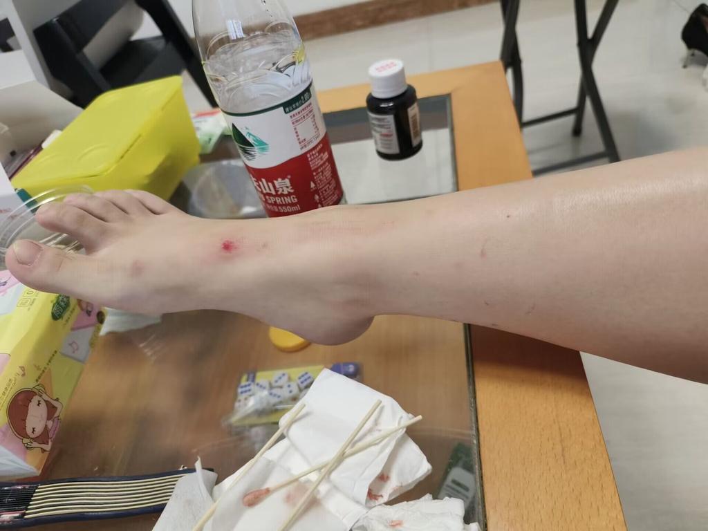 xiaolvlu's tweet photo. 初一不宜出门
😭😭😭 https://t.co/FAE0lBpoRP