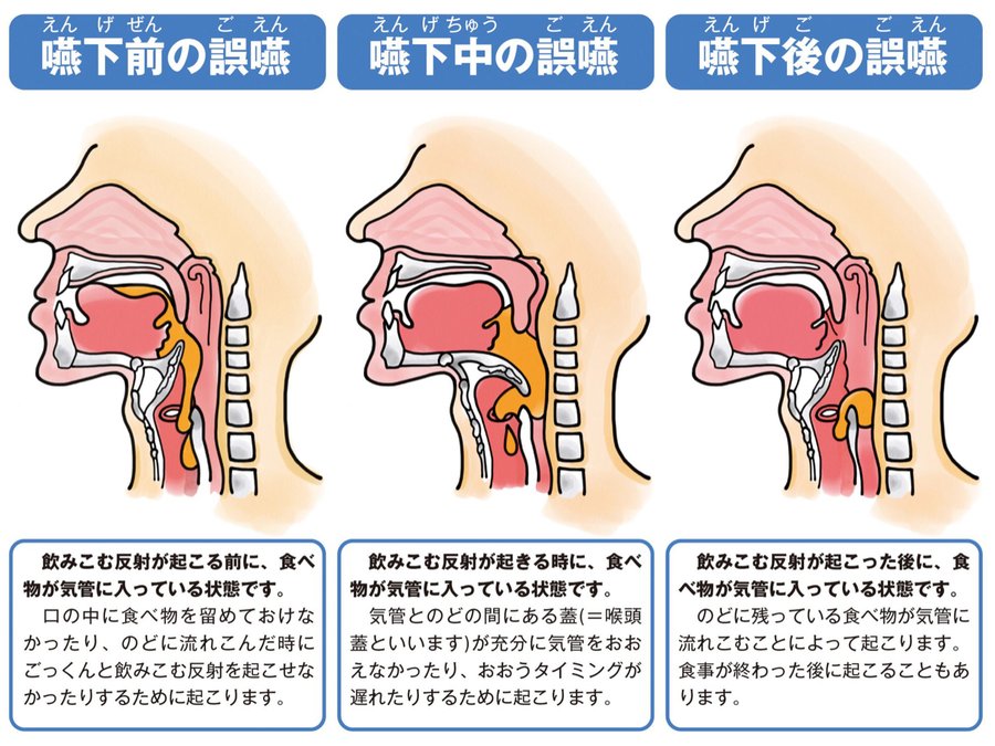 構音障害 の リハビリ 訓練 の イラスト パタカラ体操 セリフあり 口腔体操 リハビリのイラスト無料 えすてぃちゃん