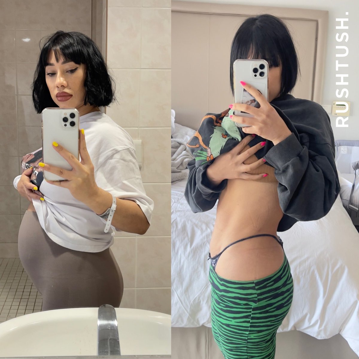 Rushtush's tweet photo. 1 day after my 4th c sec, 5 weeks post op. We beeeeen working hard. https://t.co/R9aOJE4shR