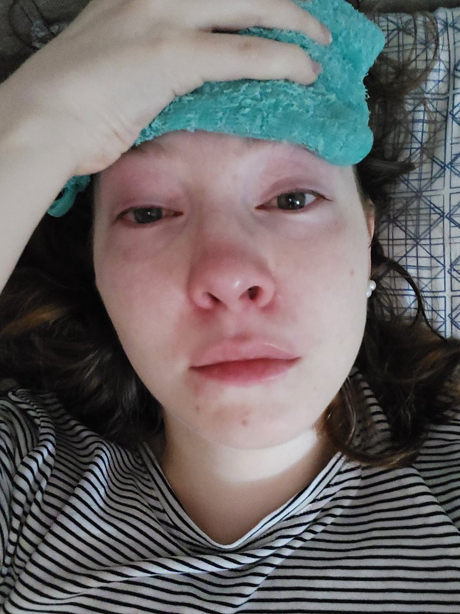 pinakooklada's tweet image. Two years ago I was studying full-time and did sports regularly. 
After two Covid-Infections I have trouble walking up the stairs and have a nearly constant pain in my head. I am not alone. We need help. #NotRecovered #longcovid #pwME #MECFS