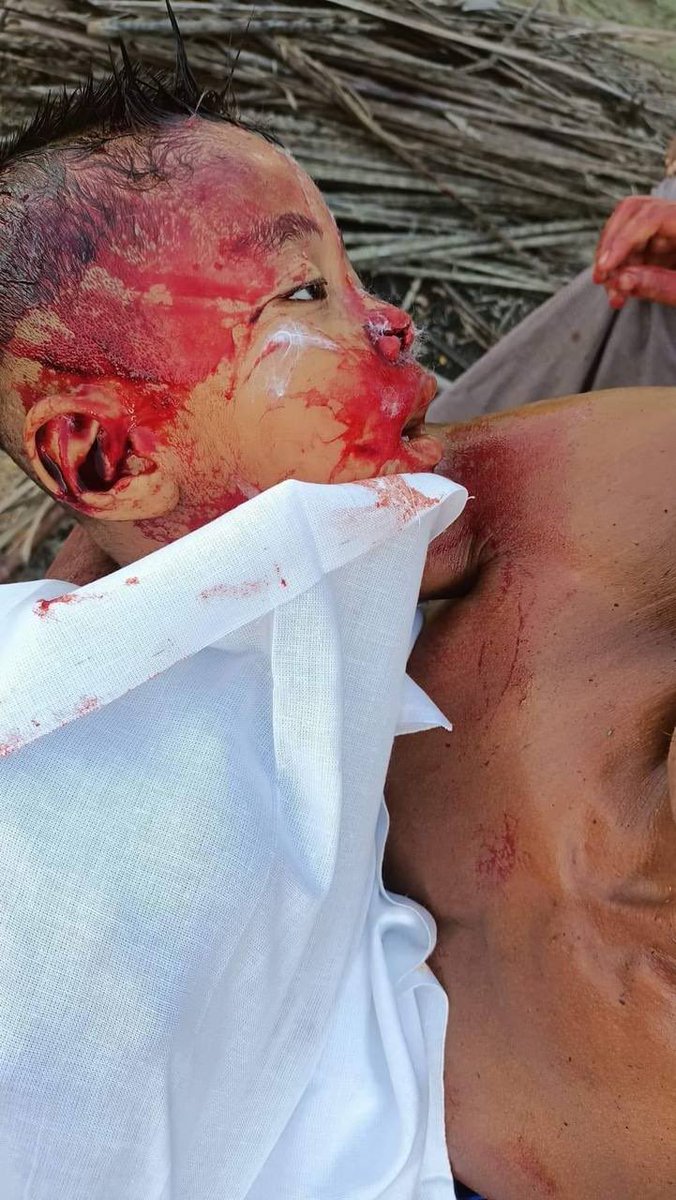 kyawhsanhlaing1's tweet photo. #Breaking On 28 Aug, the Myanmar Junta launched artillery shells many areas in Mrauk-U, killing at least 3 people incl 4 yrs old, and injured at least 11 in Kinn Seik Village,3 miles away, western part of Mrauk-U, where there was not fighting with the AA.
#WhatsHappeningInMyanmar https://t.co/ge3UOaRcpw