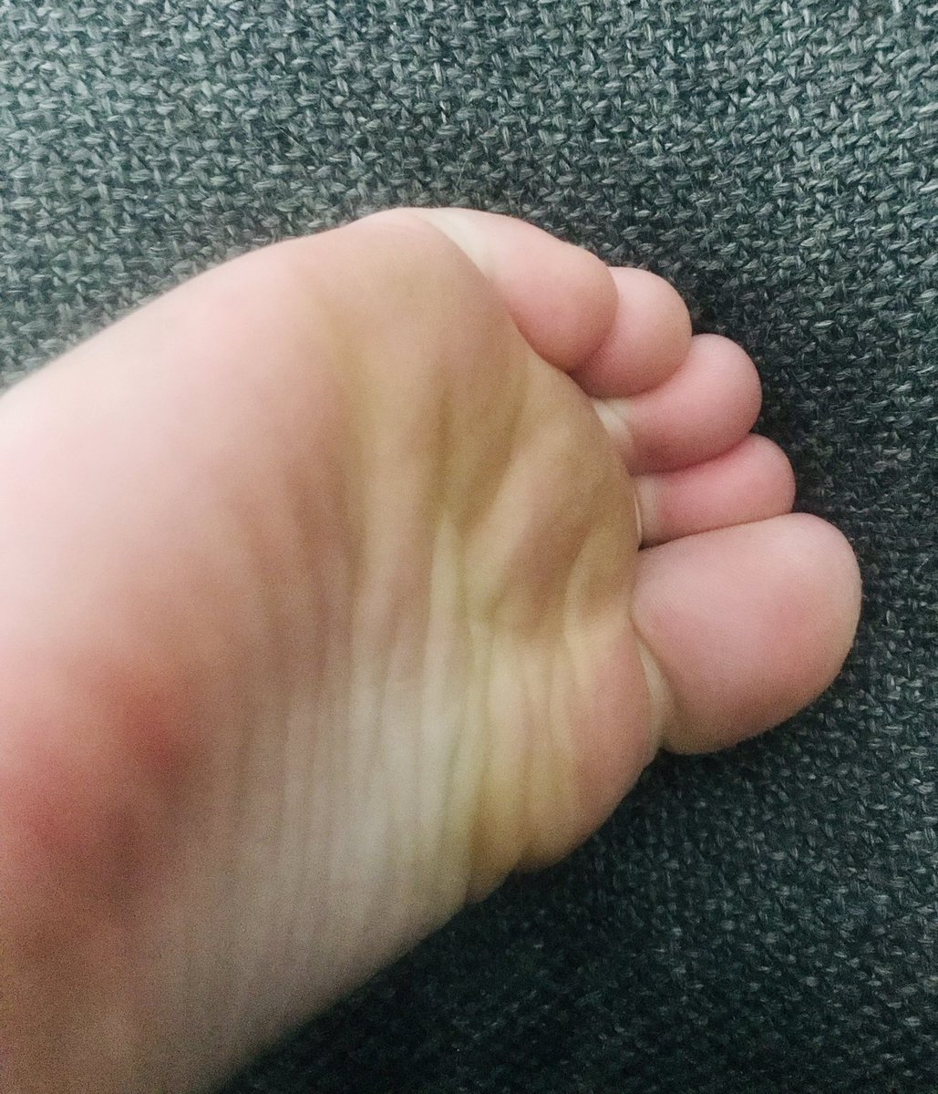 ThisLittlePinki's tweet photo. Heyyy 👋🏽  

Whose wants the kinks &amp; cracks of these hot feet 😍🦶🏼

Selling photos &amp; customs DM me or even better surprise me £ThisLittlePinkii 👀

#feet #feetworship #feetfethish #feetfinder #feetpicsforsales #feetfetiche #feetbuy #FeetPicture #findom #paypig https://t.co/JqlTnM3TNs