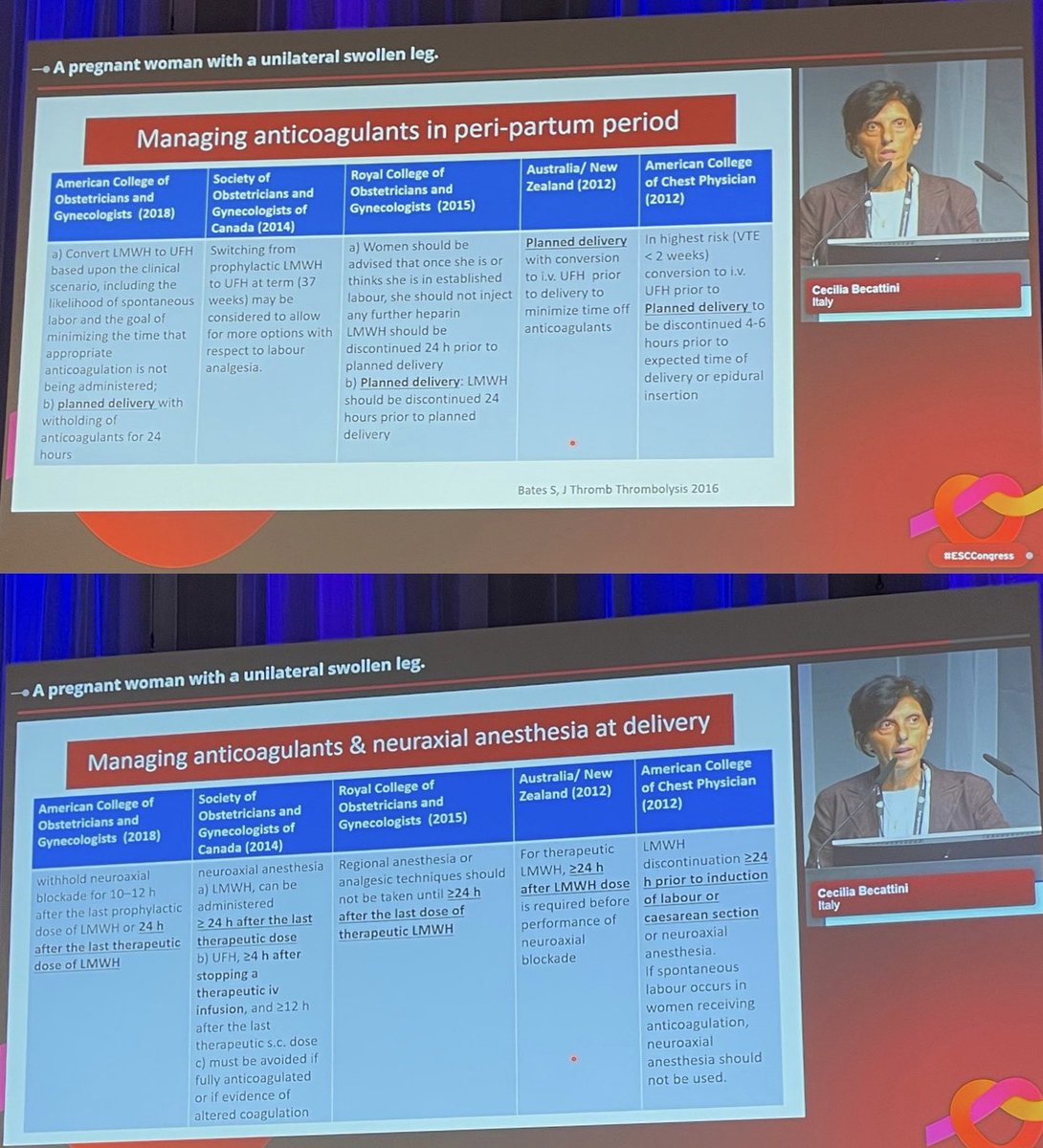 biljana_parapid's tweet photo. & Dr Cecilia Becattini ๐ฎ๐น gives a ๐ซ overview of #DVT in a 31y old ๐คฐ๐ป #worman:
๐ messages โฌ๏ธ & pls, visit for entire session:
https://t.co/dkzE6hHnNP
#CVDwomen #ESCCongress #Diversity #ABCardio4Moms #Pregnancy
@aayshacader @JGrapsa @judbacke @ZainabDakhil2 @EkateriniL https://t.co/Xe3UJ36ako