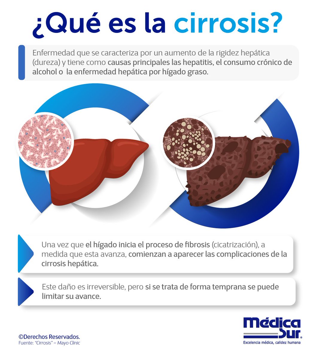 medicasur's tweet photo. ¿Sabías que la #cirrosis es una causa importante de morbilidad y mortalidad en el mundo? ¡Conoce más sobre este padecimiento y prevenlo!​

#EsteatosisHepáticaNoAlcoholica #Esteatosis #Hígado #HígadoGraso #FibrosisHepatica https://t.co/jOw5nHmVrK
