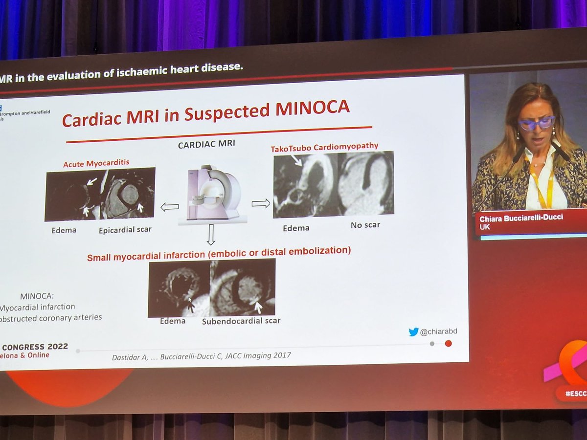 DeepDastidar's tweet photo. Always a great feeling to see your paper citation at #ESCCongress! #MINOCA #WhyCMR ⁦@chiarabd⁩ ⁦@Sarah_Moharem⁩ ⁦@mattglwilliams⁩ ⁦@arjunkg⁩ ⁦@HEARTinMagnet⁩ ⁦@purviparwani⁩ https://t.co/CfH6ls8xjZ