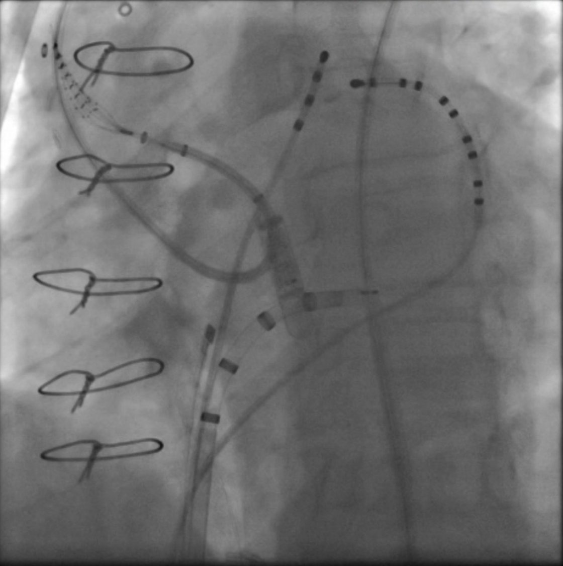 Madhu Reddy tweet media