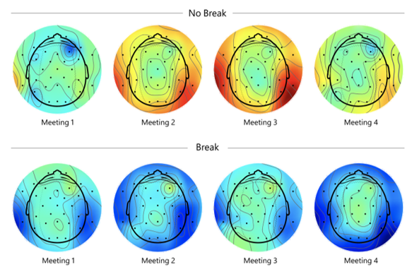 DonnaPetersCMeO's tweet photo. Give me a break. In 2021, subjects agreed to have the electrical activity in their brains monitored for stress levels when they had back-to-back meeitings vs. when they had 10-minute breaks between meetings. Time to rethink the calendar. #careercoaching #personaldevelopment https://t.co/PgK7a7XF8G