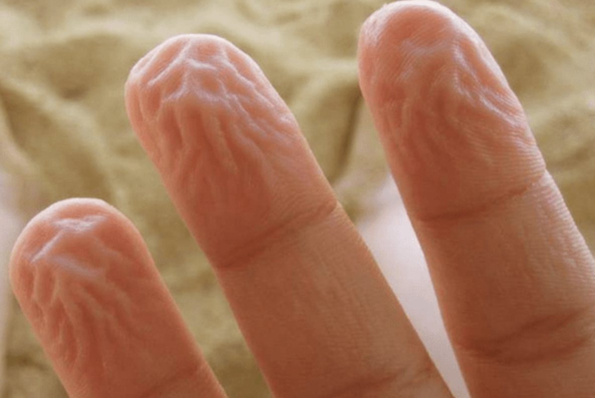 Zoeneli On Twitter If Your Fingers Don t Look Like This After top-exercises-for-finger-how-to-make-finger-longer-than-2-cm-in-2