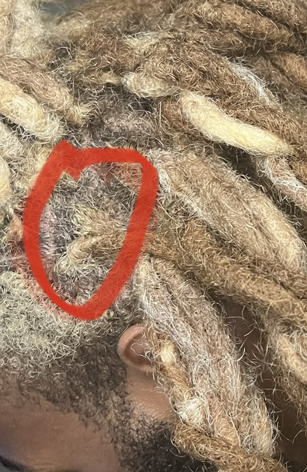 stefanartistry's tweet photo. had to reattach a loc my wonderful dog scratched out my head during a hug some time ago 😒 but it’s ok. He’s back on there. Back to 120 locs 😂 #menwithlocs #locrepair https://t.co/T1D295aGQD